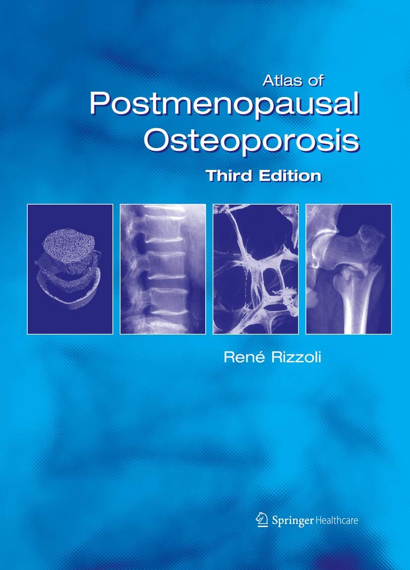atlas of postmenopausal osteoporosis: third edition