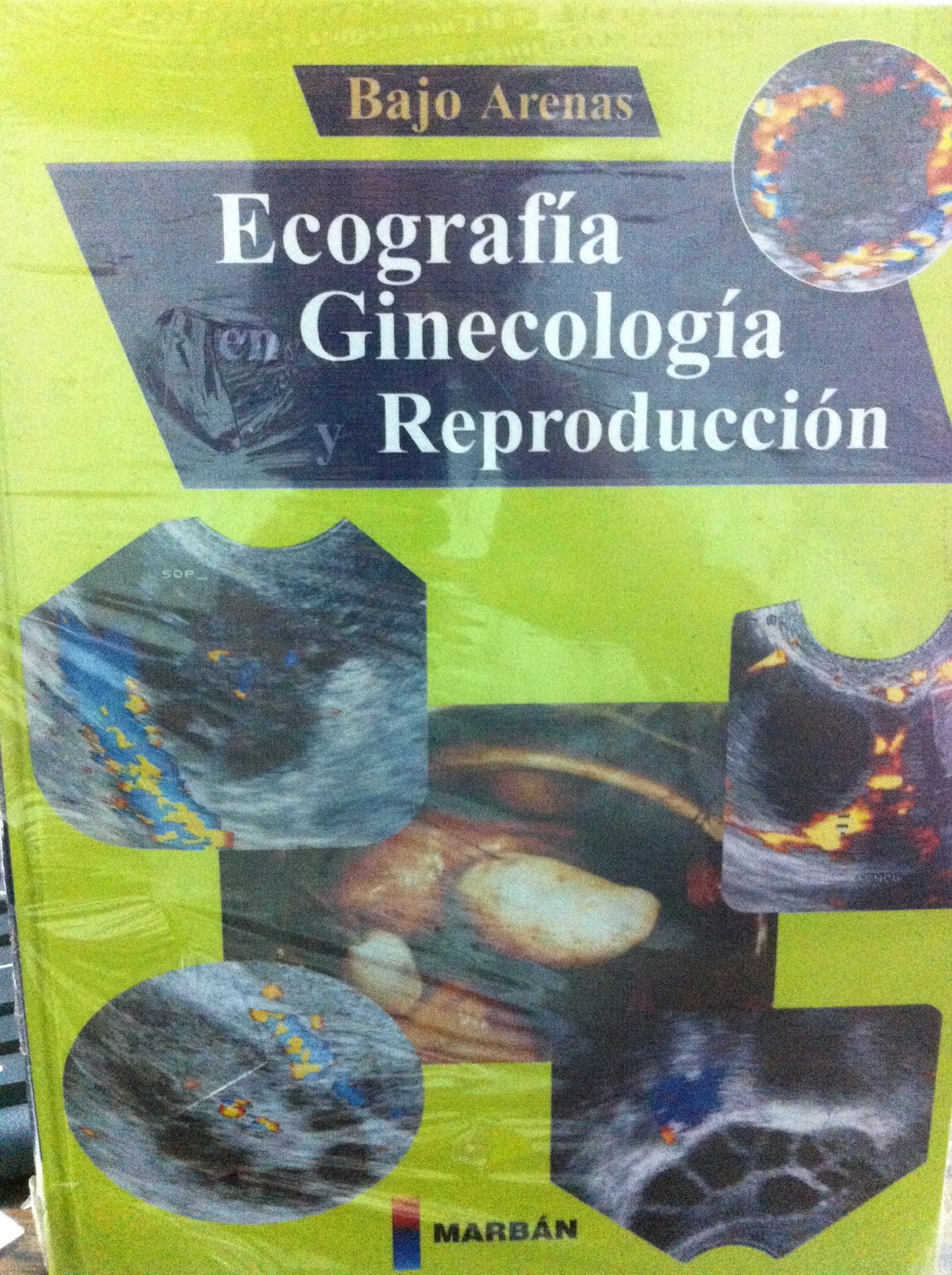 ecografía en ginecología y reproducción